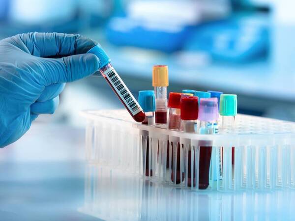 Lab test